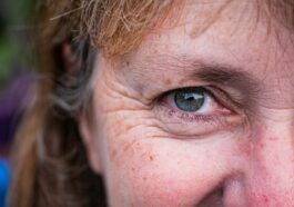 a close up of a person with freckled hair